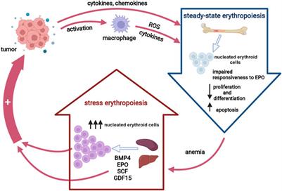 Targeting Stress Erythropoiesis Pathways in Cancer